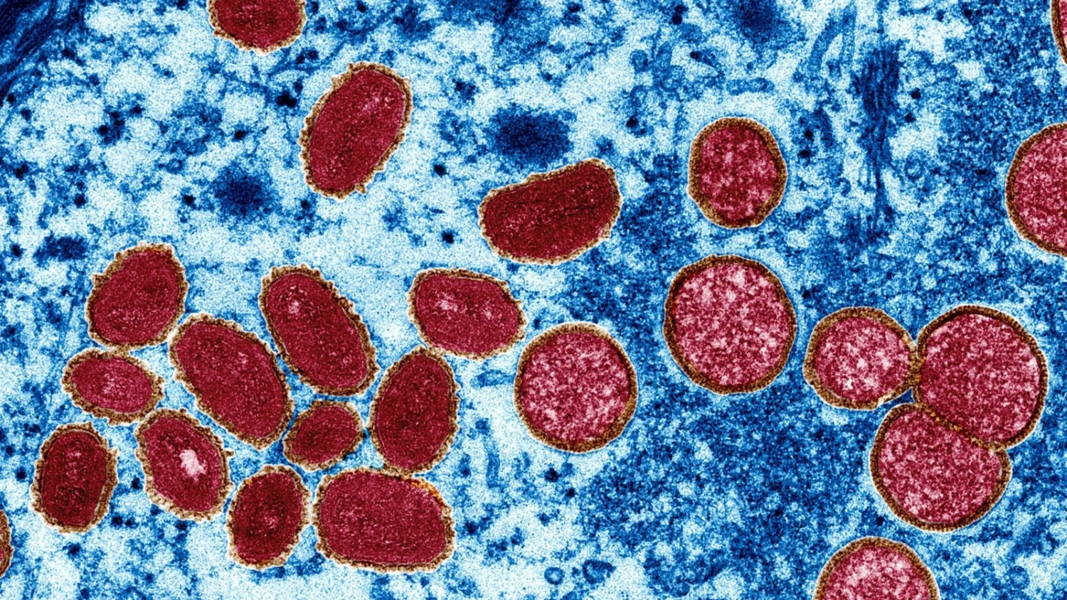 RN não registra novos casos de monkeypox há seis meses