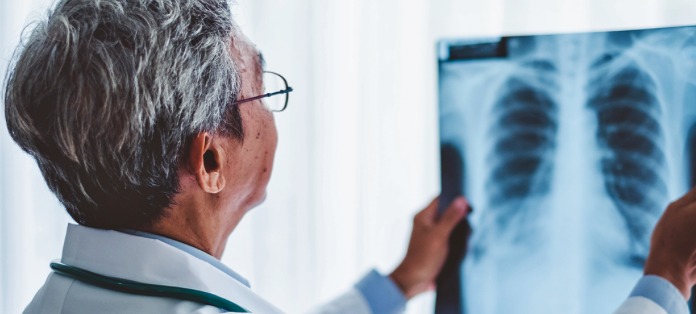 UFRN seleciona homens de 60 a 80 anos para pesquisa sobre força, equilíbrio e função pulmonar