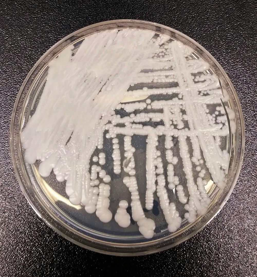 Sesap orienta hospitais do RN sobre superfungo Candida auris